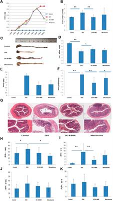 Berberine-Loaded Carboxylmethyl Chitosan Nanoparticles Ameliorate DSS-Induced Colitis and Remodel Gut Microbiota in Mice